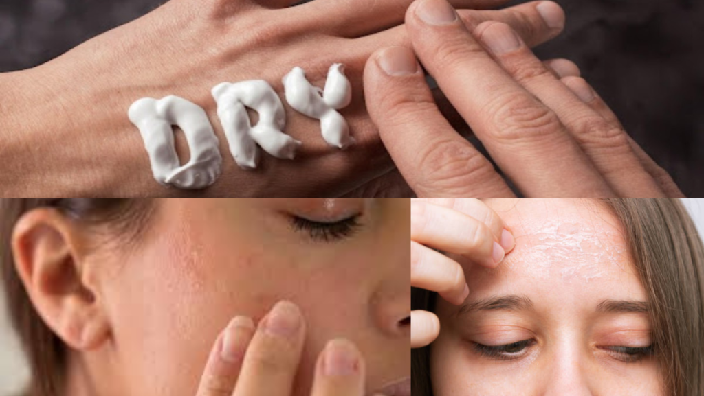 moisturizer for dry skin